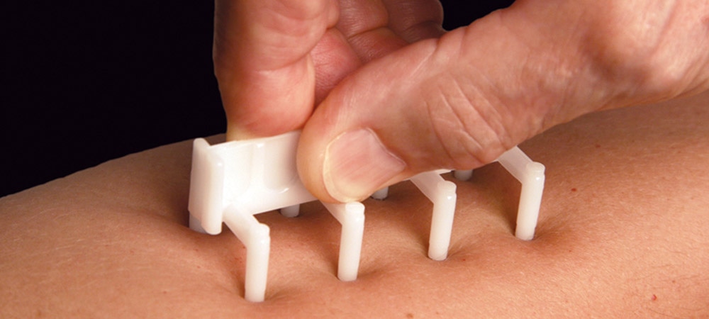 Allergietest Wien – Privat und Professionell in Ihrer HNO-Praxis