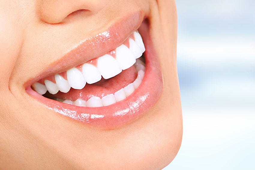 Transparente Zahnschiene: Die Vorteile von Invisalign für Ihre Zahnstellungskorrektur