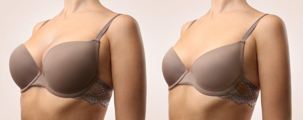 Ästhetik Centrum Bochum: Ihr Partner für plastische Chirurgie in Bochum