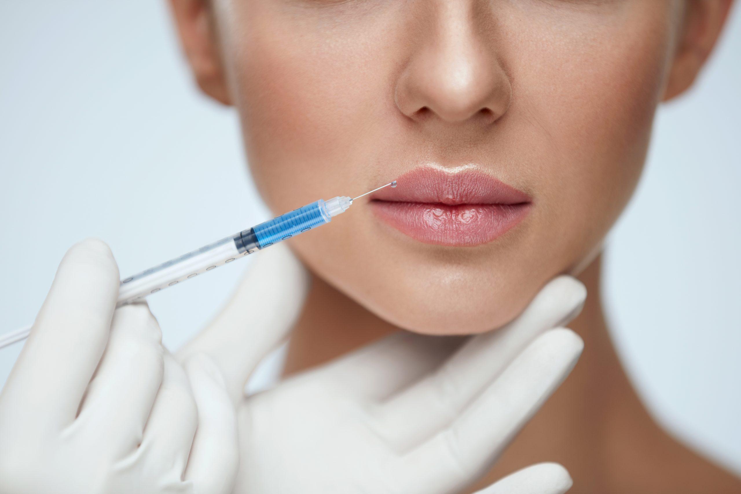 Lippen Aufspritzen Nürnberg: Perfekte Lippen und Hautstraffung bei MY AESTHETICS in Nürnberg