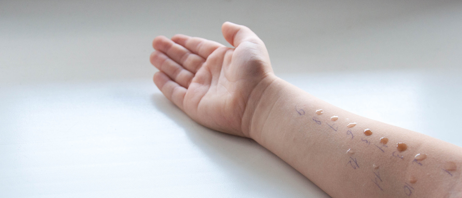 Allergietest Wien – Privat und Professionell in Ihrer HNO-Praxis
